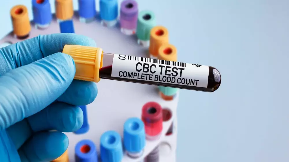 Complete Blood Count